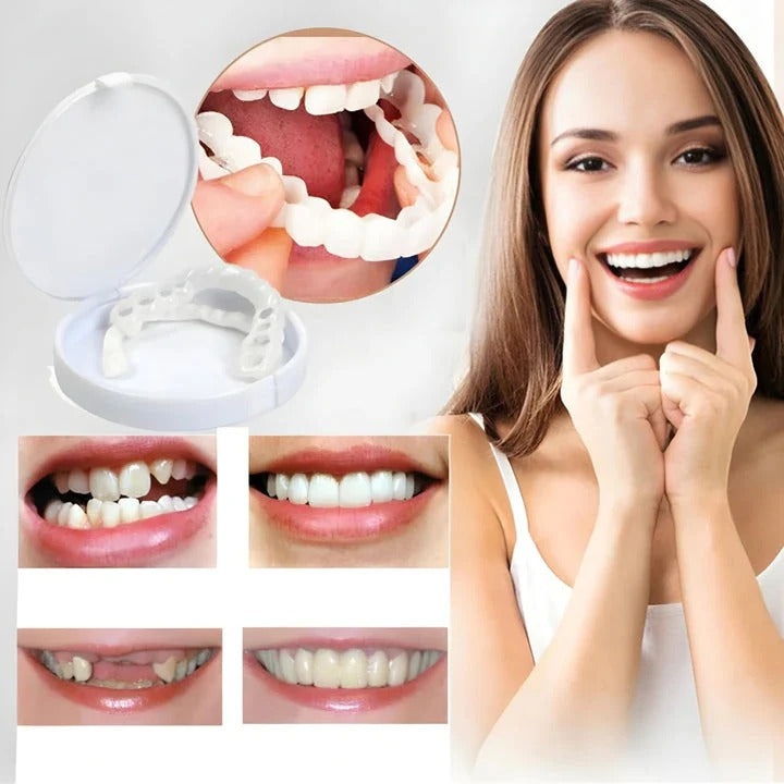 2Pcs/Set Comfort Fit White Teeth Cover Veneer Kit